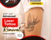 Say Goodbye to Unwanted Tattos